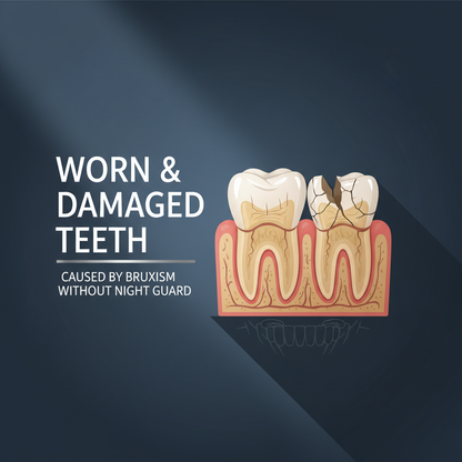 Worn & Damaged Teeth